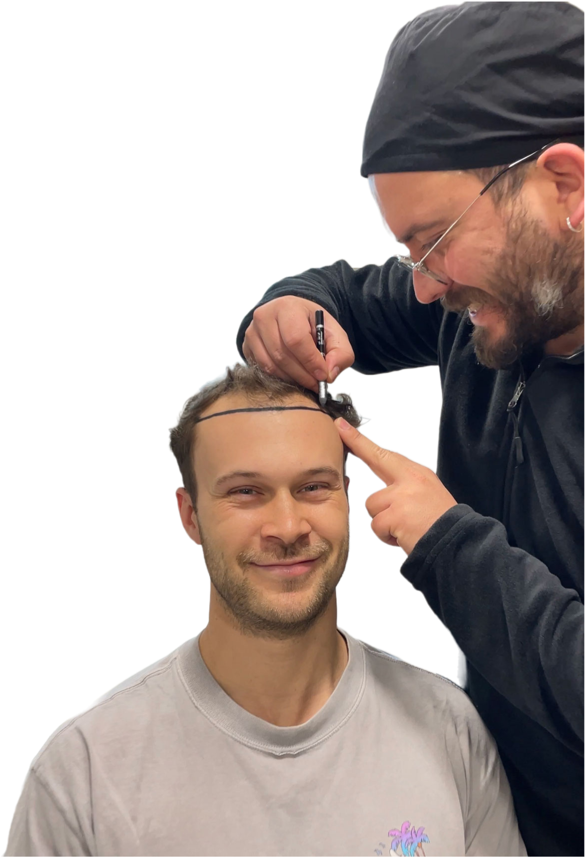 Fue Hair Transplant