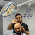 Hair Transplant Methods FUE, DHI, or FUT – Which is Right for You?